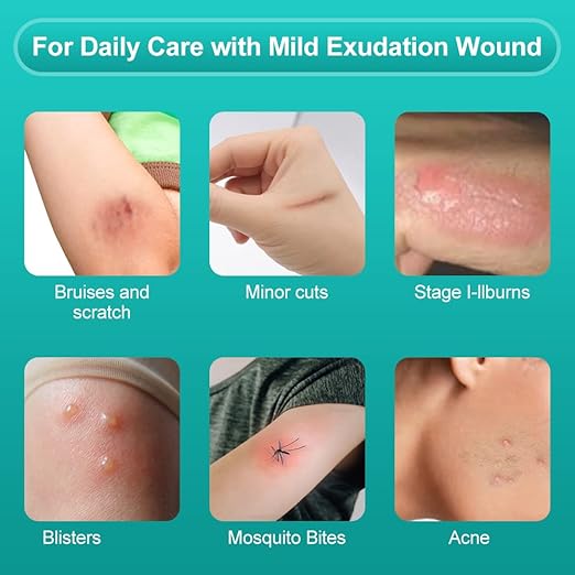 Dimora Hydrocolloid Wound Dressing, 10 Pack Ultra Thin 4" x 4" Large Patch Bandages with Self-Adhesive, Fast Healing for Bedsore, Burn, Blister, Acne Care, Sterile and Waterproof