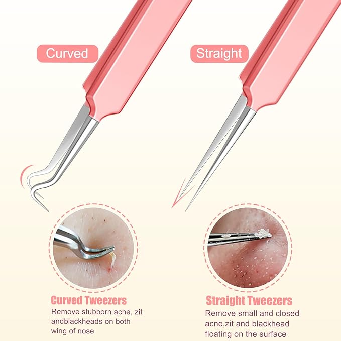 Ingrown Hair Tweezers and Pimple Popper Tool Kit, Pink Blackhead Remover Tools, Pimple Extractor Pore Extractor Eyebrow Razor, Scissor in Leather Travel Case