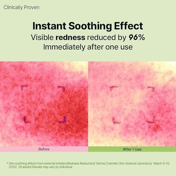 HYCICA Soothing Balance Cream Moisturizer | Calming Hydration Barrier Care for Sensitive Skin, Centella, Ultra-Low Molecular Hyaluronic Acid, Vegan Fragrance-Free Korean Skincare, 2.70 fl oz