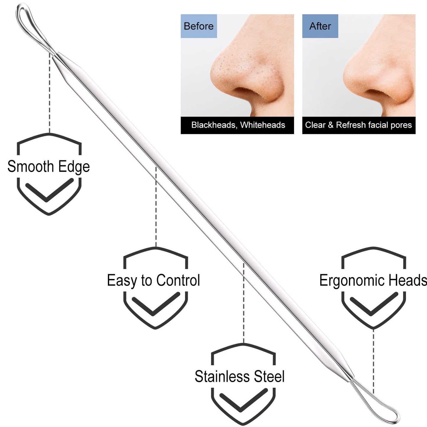 Azosowo 2-Pack Pimple Extractor Tools, Blackhead Remover Tools, Blackhead Extractor, Pimple Popper Tool Kit for Zit, Comedone, Acne, Whitehead - with Case