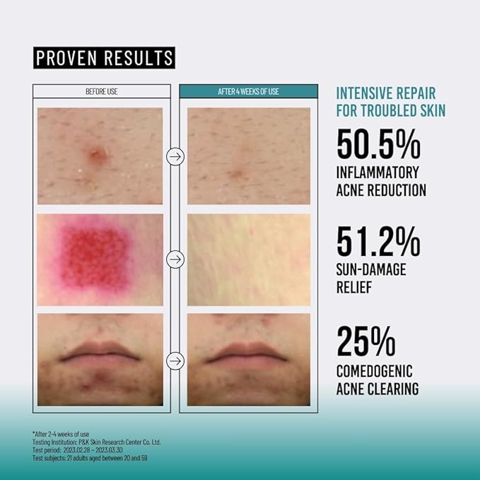 JUMISO Snail Mucin 95 Peptide Essence - Korean Face Toner with 5-Peptide Complex - Acne Sun Damage Repair Non-Comedogenic Texture Improvement Fragrance Free Cruelty Free All Skin Types 4.73 fl.oz.