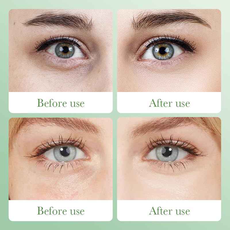 36 Pairs Under Eye Patches & Lip Mask for Puffy Eyes and Dark Circles - Crystal Lip Care Gel Pads Mask Bulk Collagen Skin Care Products, Beauty & Personal Care