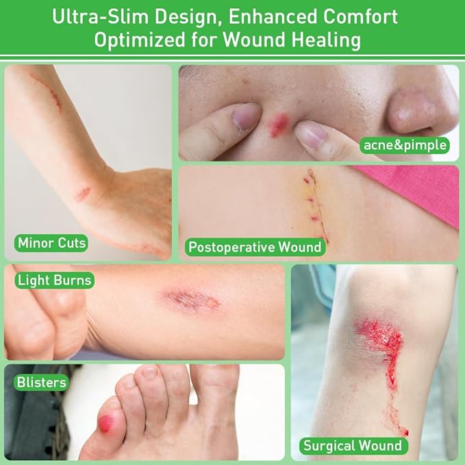 Hydrocolloid Bandages,Hydrocolloid Roll for Wound Care Large hydrocolloid Bandages Patch with Self-Adhesive Waterproof Ultra Absorbent Flexible DIY Size & Shape First Aid Kit Essential (2in*16ft)