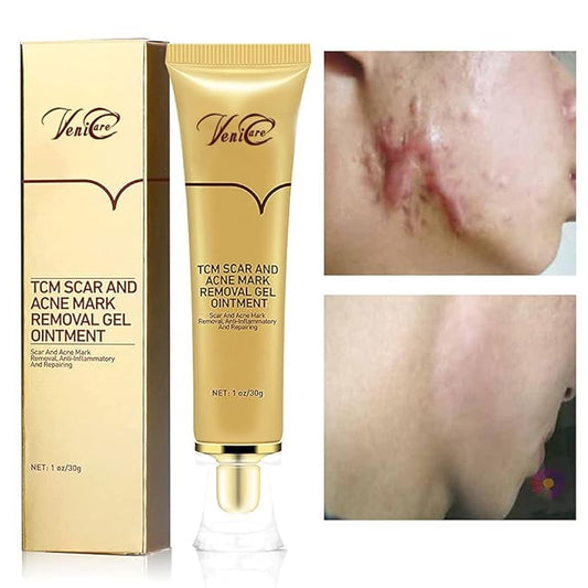 Acne Scar Removal Cream Stretch Marks (Packaging
