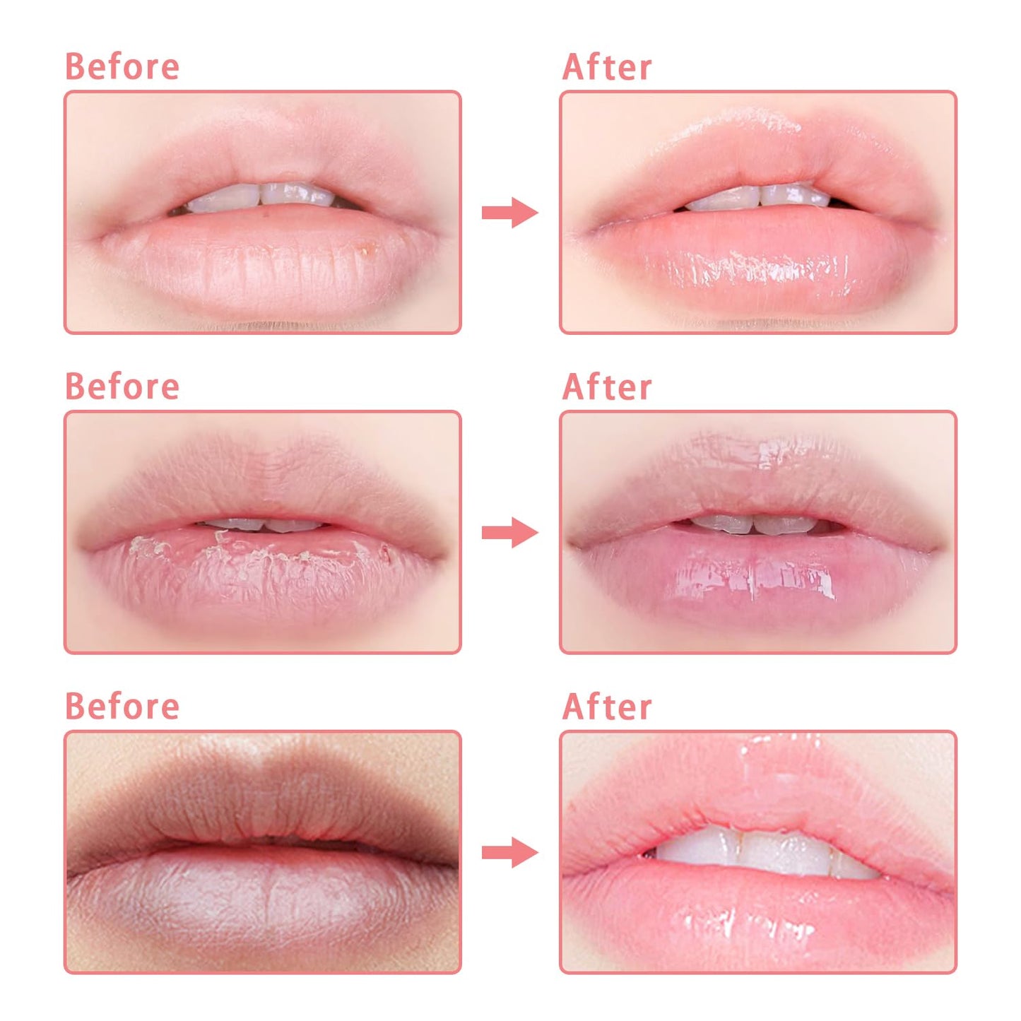 3 Pcs Bee Lip Balm Honey Pot, Coconut Watermelon Apple Lime Lip Mask Overnight, Moisturizing Lip Sleeping Mask, Hydrate Repair Prevent Dry Cracked Lip Exfoliator (Coconut +Watermelon+Apple Lime)