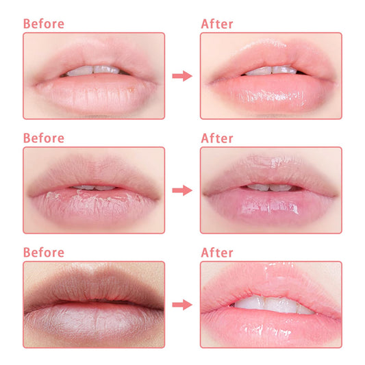 3 Pcs Bee Lip Balm Honey Pot, Coconut Watermelon Apple Lime Lip Mask Overnight, Moisturizing Lip Sleeping Mask, Hydrate Repair Prevent Dry Cracked Lip Exfoliator (Coconut +Watermelon+Apple Lime)