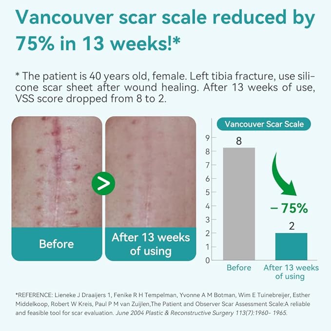 Dimora Professional Silicone Scar Sheets -