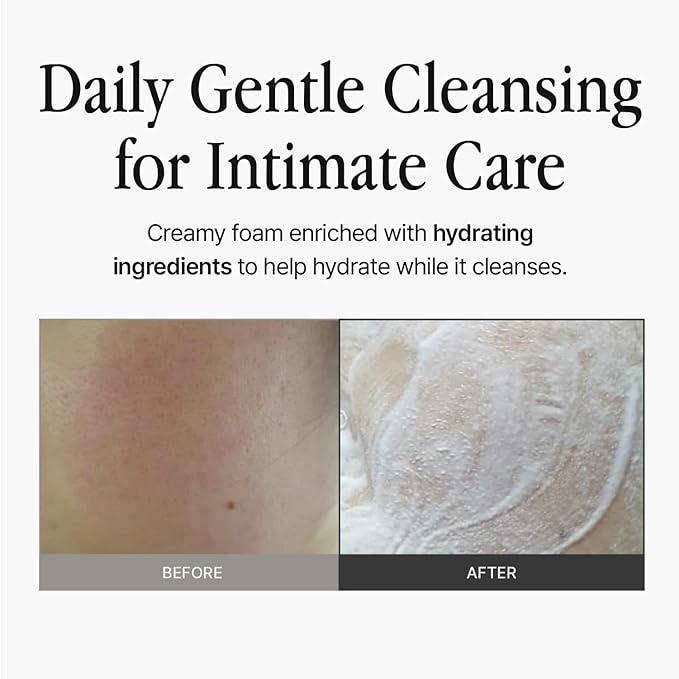 Feminine Wash 3.38 fl oz – Mild pH-Balanced Foam Cleanser for Sensitive Skin, Gentle Botanical Formula, Daily Use, Fragrance-Free