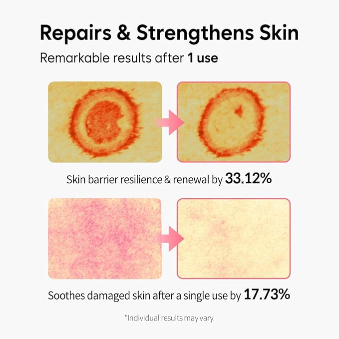 Dragon Blood Cream 30ml, Anti Aging Moisturizer for Face, Deep Wrinkle Repair & Skin Elasticity Improvement, Clinically Proven, Day & Night Use, Hydrates & Soothes All Skin Type