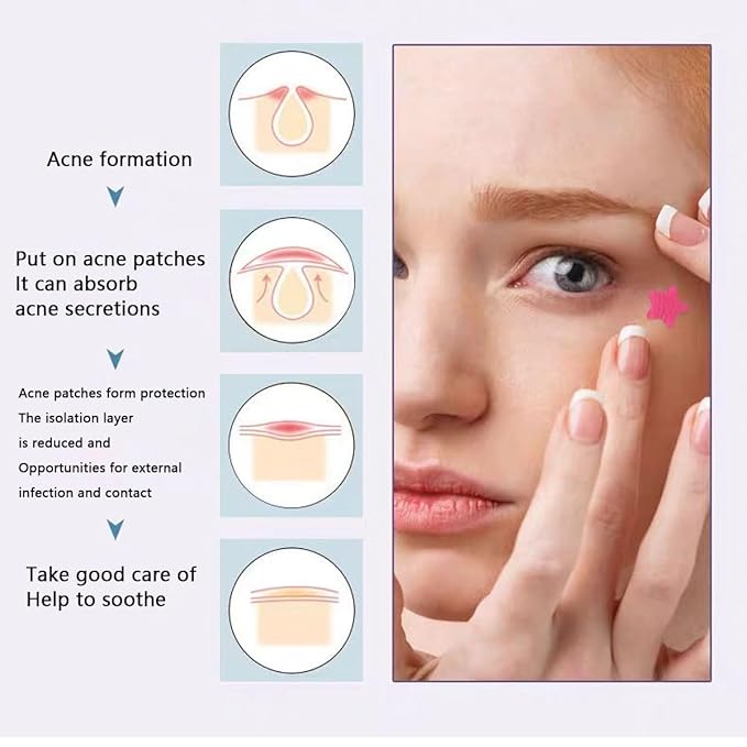 Pimple Patches Pimple Patches Midnight Magic，Salicylic Acid & Tea essential oil - Pimple Patches for Face, Hydrocolloid Acne Patch, Cute Face Stickers, Zit Patch（216pc）