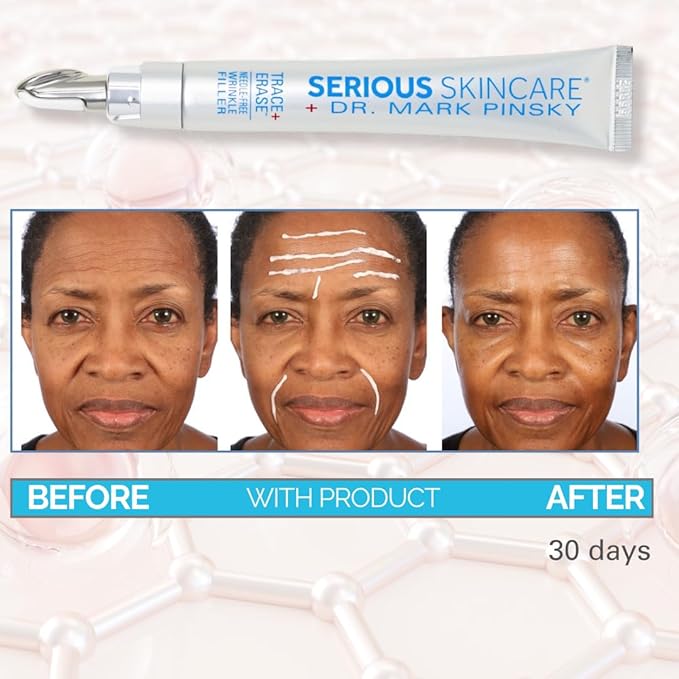 Serious Skincare - Deep Wrinkle Filler for Face and Neck - Dr. Mark Pinsky Trace + Erase Wrinkle Filler and Enzyme+ Prep Treatment Pads - For Plumper, Smoother Skin - Hyaluronic Acid and Peptides