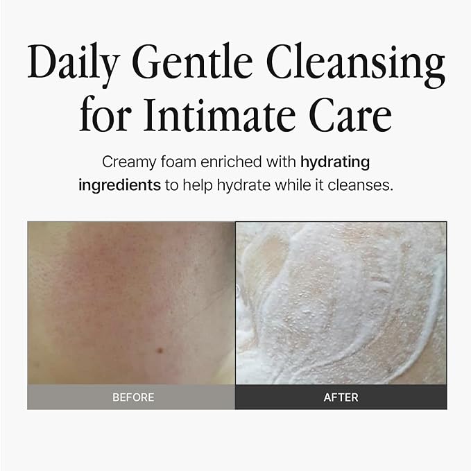 Feminine Wash 1.01 fl oz – Mild pH-Balanced Foam Cleanser for Sensitive Skin, Gentle Botanical Formula, Daily Use, Fragrance-Free