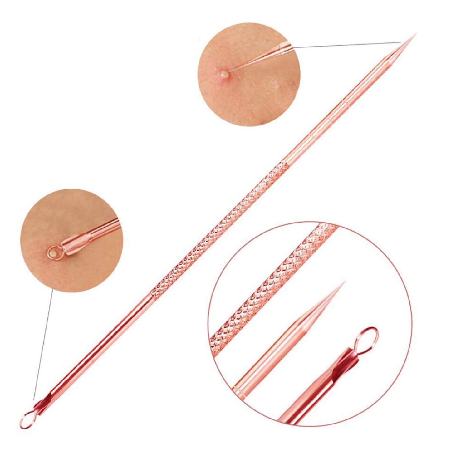 ZTRHYOO Blackhead Remover Pimple Comedone Extractor Tool Best Acne Removal Kit - Treatment for Blemish, Whitehead Popping, Zit Removing for Risk Free Nose Face Skin with Case(Rose, 4 Piece Set)