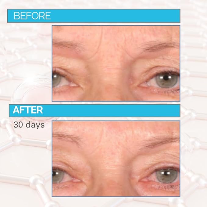 Serious Skincare - Deep Wrinkle Filler for Face and Neck - Dr. Mark Pinsky Trace + Erase Wrinkle Filler and Enzyme+ Prep Treatment Pads - For Plumper, Smoother Skin - Hyaluronic Acid and Peptides