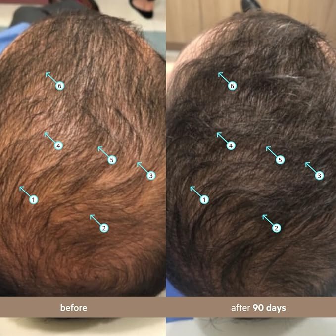 DS Labs Spectral Men's Formally Spectral.DNC-N - Hair Density Serum, Strengthening, Thickening, Minimize Shedding, Color Safe, 60mL, Packaging May Vary