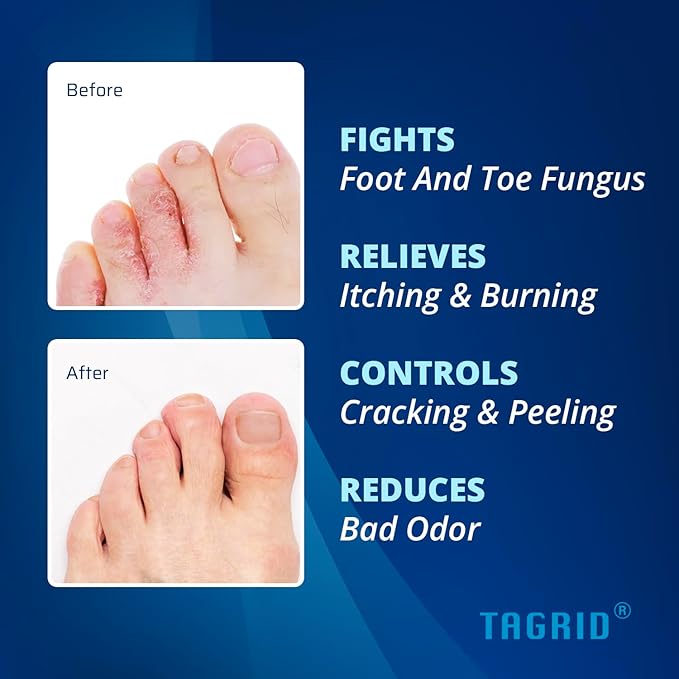 TAGRID Athletes Foot Treatment (3.5 OZ): Maximum Strength Antifungal Cream for Athletes Foot Fungus Jock Itch Ringworm Treatment for Humans - Anti Fungal Itch Cream for Itchy Skin Relief