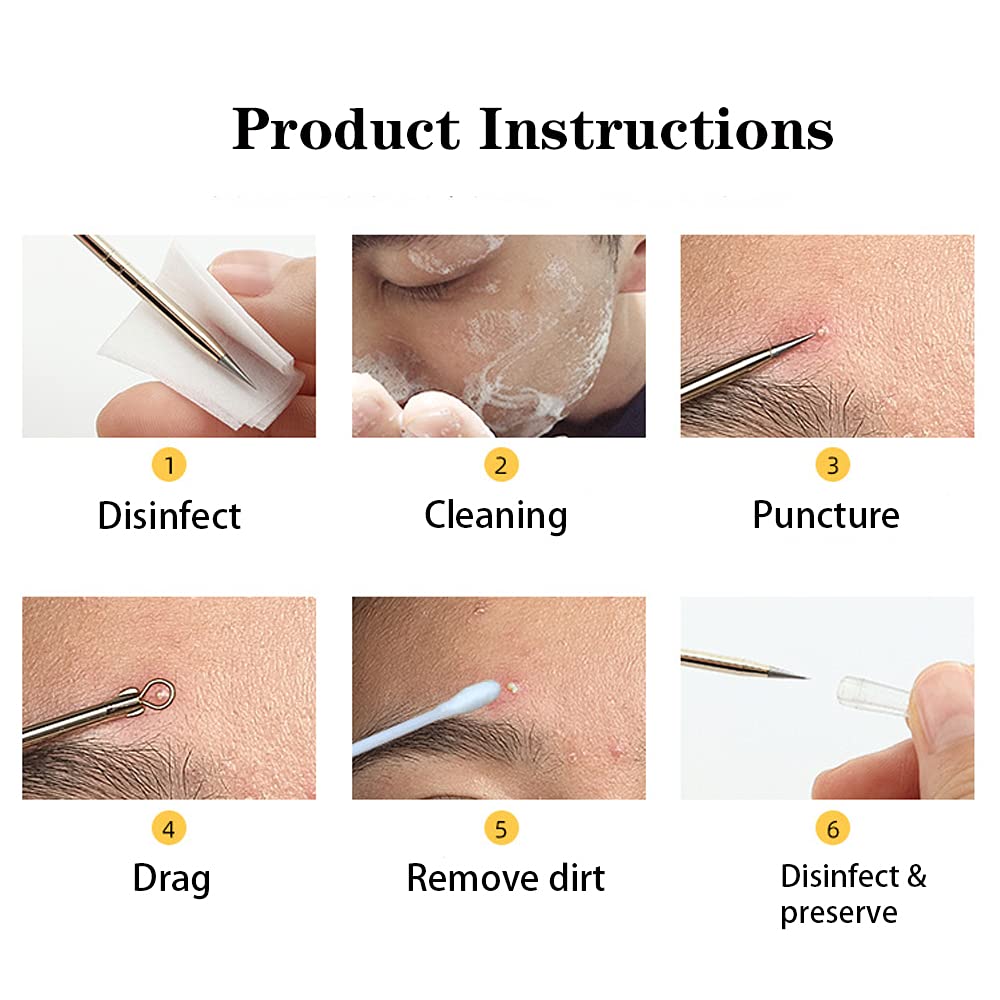 Blackhead Remover Pimple Popper Tool Kit 4 Pcs Acne Comedone Zit Blackhead Extractor Tool for Nose Face,Stainless Steel Whitehead Popping Removal Tool Set