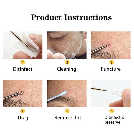 Blackhead Remover Pimple Popper Tool Kit 4 Pcs Acne Comedone Zit Blackhead Extractor Tool for Nose Face,Stainless Steel Whitehead Popping Removal Tool Set