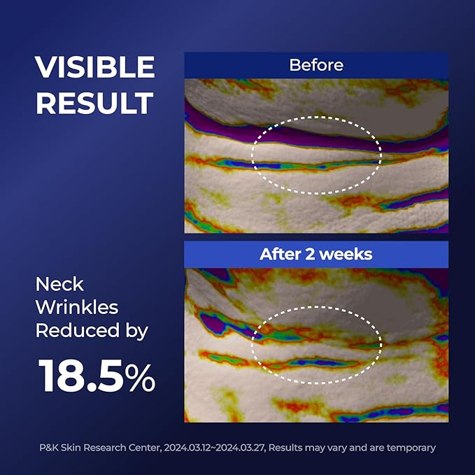 DOMINAS Atclinic Neck Firming Serum with Retinol & 5-Peptides – Reduce Wrinkles & Tech Neck Lines in 2 Weeks | Lightweight, Korean Skincare (1 fl oz)