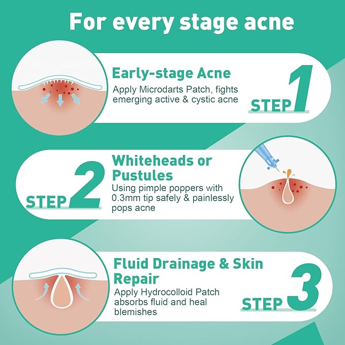 3-Step Microdart Pimple Patches Set – 83 Count, including 9 Microdarts Pimple Patches, 50 Pimple Poppers, and 24 Hydrocolloid Patches