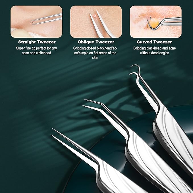 FVION Blackhead and Acne Extractor Kit, Professional Pimple Popper Tool Kit, Acne Tweezers and Blackhead Remover Tools for Face, 6 PCS Surgical Extractor Pimple Popping Tools