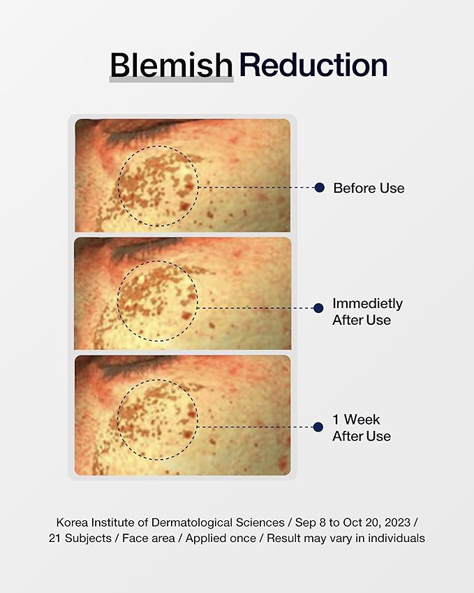 CENTELLIAN 24 Expert Madeca Cream (1.69fl oz) - Premium Lasting Hydration Moisturizer for Dry, Sensitive Skin. Centella Asiatica, TECA, Gotu Kola