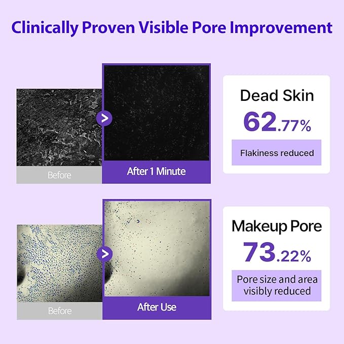 DERMAFIRM Peptology Retinoid Ampoule - GLASS SKIN with Peptides & Niacinamide - Anti Aging Face Serum for Pore Minimizer, Skin Texture Improvement & Wrinkle Reducer - Korean Skincare 30ml