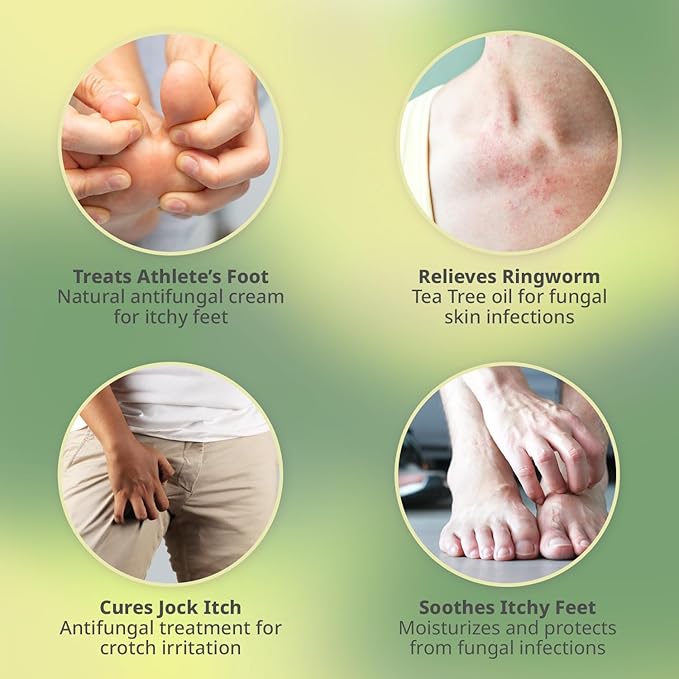 PURPLE CANYON Anti Fungal Balm with 15% Undecylenic Acid – Natural Antifungal Cream for Athletes Foot, Jock Itch & Ringworm – Soothing Relief with Tea Tree, Menthol & Healing Essential Oils