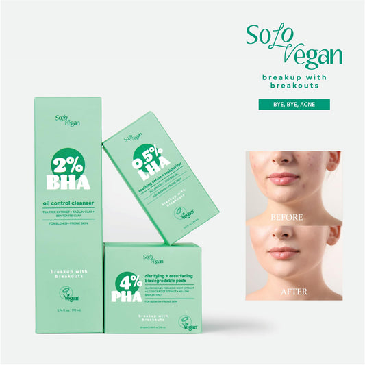 SoloVegan 4% PHA Toner Pads | Vegan Korean Skincare for Sensitive, Acne-Prone Skin, Before Makeup, Morning Routine Selfcare, (Toner Pads, 60 ct)