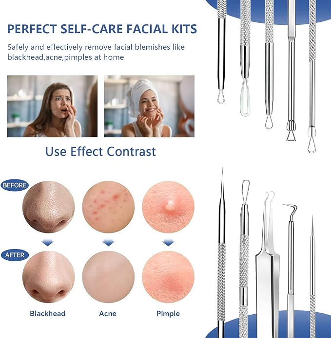 6 Pcs Blackhead Remover Tools,Blackhead Extractor,Pimple Popper Tool Kit for Blackhead, Whitehead, Acne, Zit, Comdone, Pores, Fat Granules, Blemishs on Nose, Face & Ear