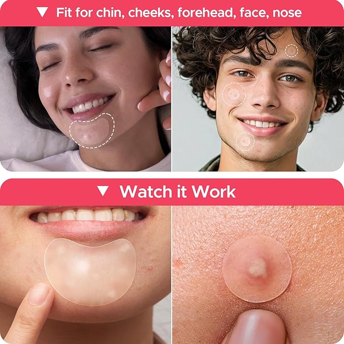 LitBear Large Pimple Patches, 5 Size 224 Count Big Acne Patches for Face, Chin, Forehead and Body, Zit Patches for Dots, Blemishes and Large Breakouts, Hydrocolloid Patch (XL Strip, Contoured, Round)