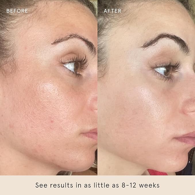 Barefaced Clear Skin Duo - Toning Pads & Toning Pads II - Renew, Resurface and Clear Dull, Dry or Acne-Prone Skin