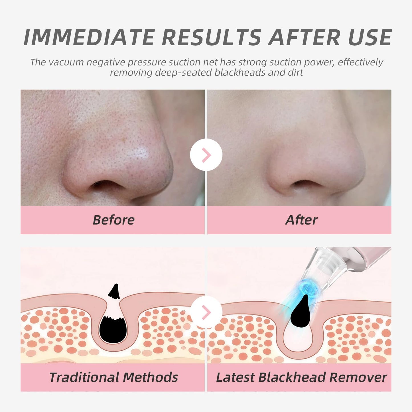 Blackhead Remover Pore Vacuum, Face Cleaner Extractor, 4 Suction Heads & 3 Adjustable Modes, USB Charging Interface, Blackhead Vacuum Kit for Women&Men(Pink)
