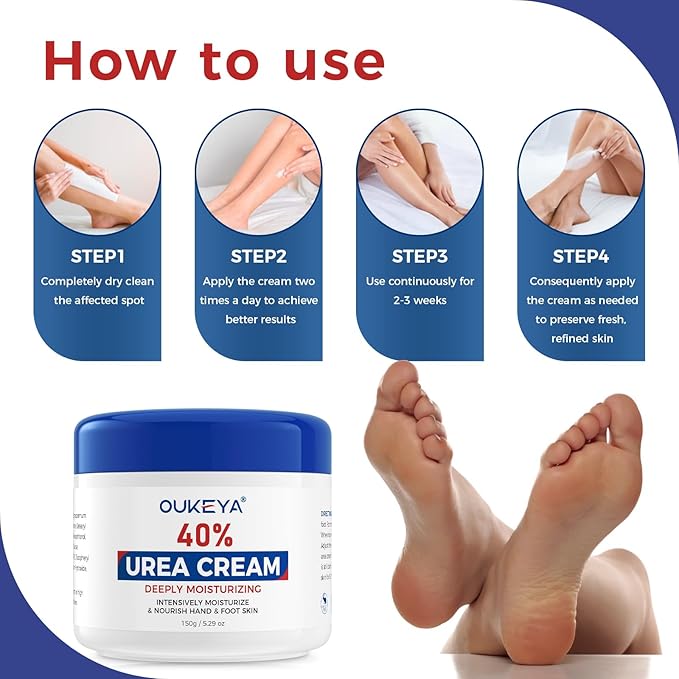 OUKEYA NEW FORMULA Urea Cream 40 Percent for Feet Maximum Strength, Hand Heels Dry Cracked Treatment Lotion for Knees & Elbows, Foot Dead Skin Cuticle Callus Remover Toenail Softener, 5.29 oz