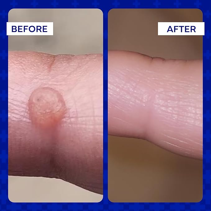 emuaid Ointment for Eczema and Psoriasis Relief, Reduces Itching, Pain, Swelling, Regular Strength Treatment for 100+ Skin Conditions, Steroid and Chemical-Free, Suitable for All Ages, 2oz