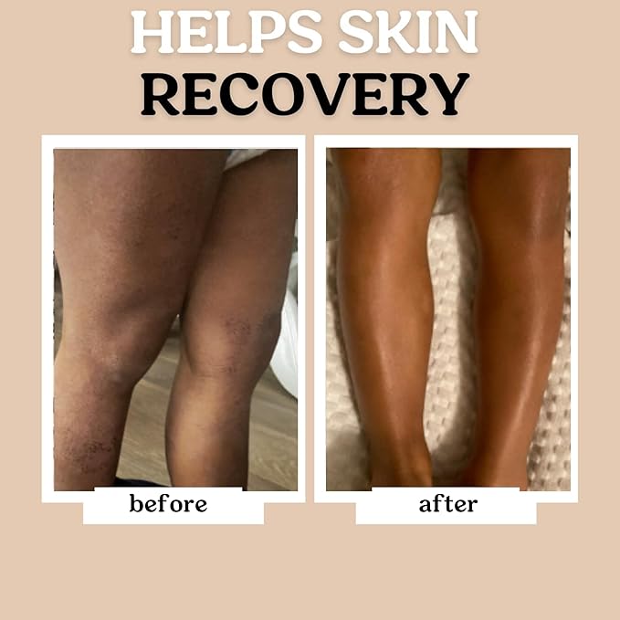 Roe Wellness- Baby Lotion Moisturizer Fragrance-Free | Great For Sensitive Skin Lightweight Moisturizing Lotion | For Babies, Infants, Kids and More