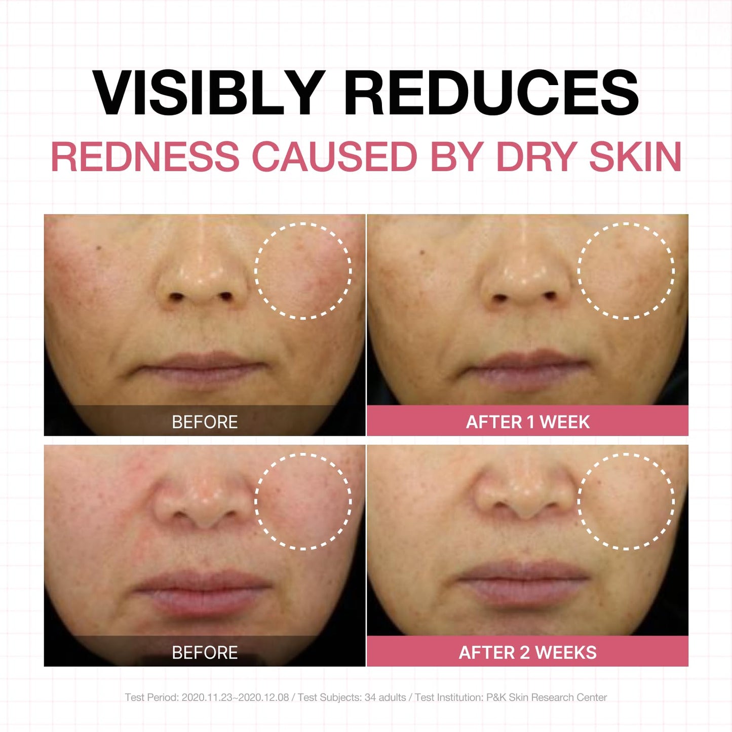 Physiogel Calming Relief Face and Body Lotion, Reduces Redness in just 3 days, Moisturizer for Dry, Red, Itchy, Sensitive Skin, Korean skin care, Fragrance-Free, Non-Comedogenic, Dermatologist-Tested