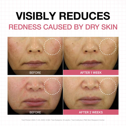 Physiogel Calming Relief Face and Body Lotion, Reduces Redness in just 3 days, Moisturizer for Dry, Red, Itchy, Sensitive Skin, Korean skin care, Fragrance-Free, Non-Comedogenic, Dermatologist-Tested