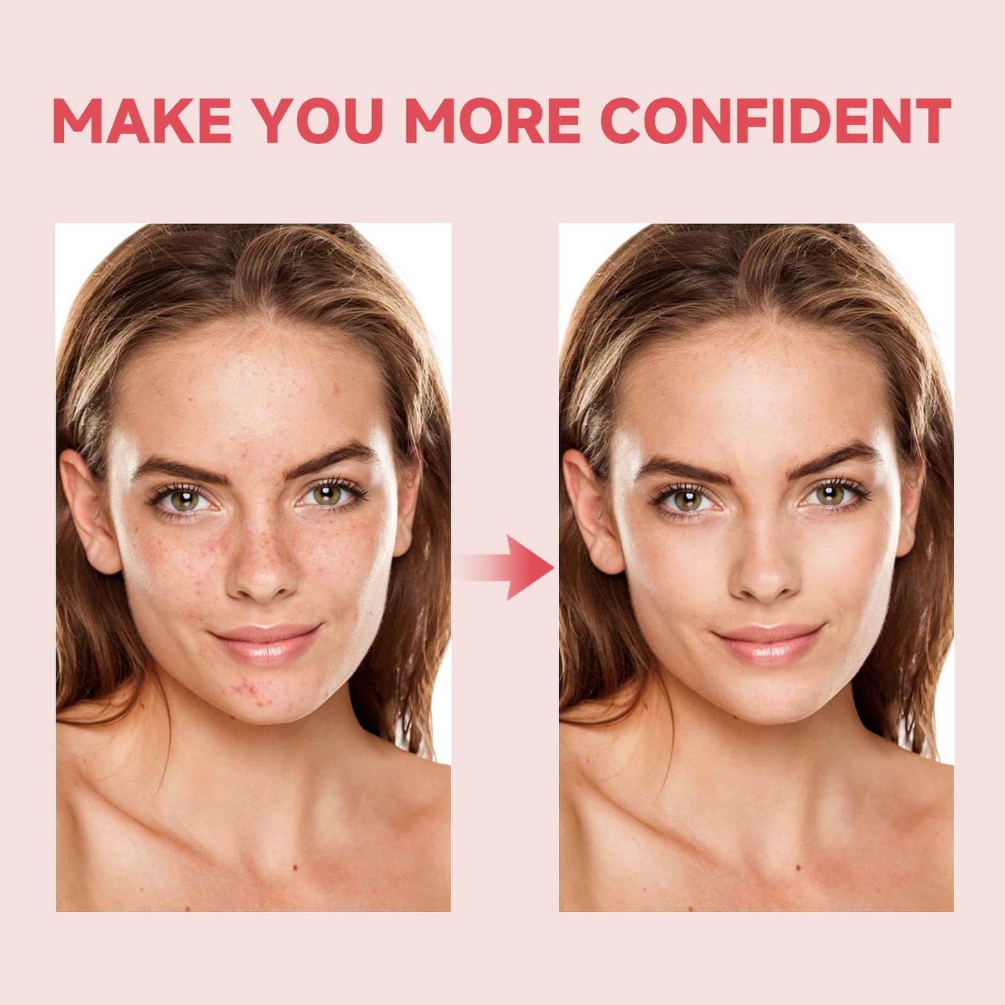 Niacinamide Serum, Niacinamide Serum 10% + TXA 4% Acid for Face, 2 Pack Tranexamic Hyaluronic Acid Essence for Face All-in-One Women Daily Korean Skincare Hydration, 30ml