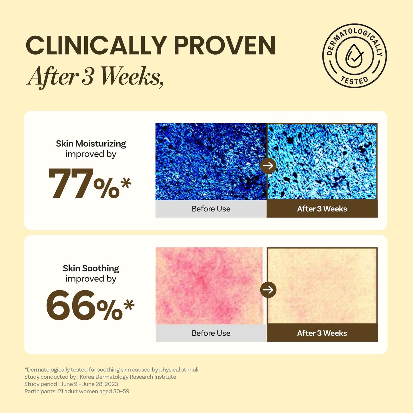 ONGREDIENTS Skin Barrier Calming Lotion | Lightweight Moisturizer for Dry, Sensitive Skin | Centella, 9-Peptide Complex, Glucose, Soothing, Calming, Hydrating | Vegan, Korean skincare (7.43 fl Oz)