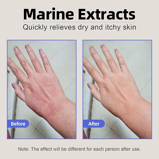 Natural Organic Eczema Soothing Cream Made With Sea Moss Aloe Vera, Oats! Sensitive Skin Dry Skin Hydrating Comfort Moisture Fragrance Free Skin care