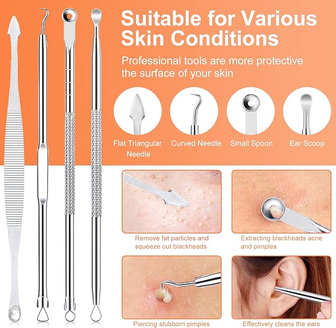 Pimple Popper Tool Kit, IUMAKEVP 15 PCS Professional Stainless Steel Blackhead Remover Comedone Extractor Tools for Removing Zit on Face - Acne Removal Kit with Metal Case (Silver)