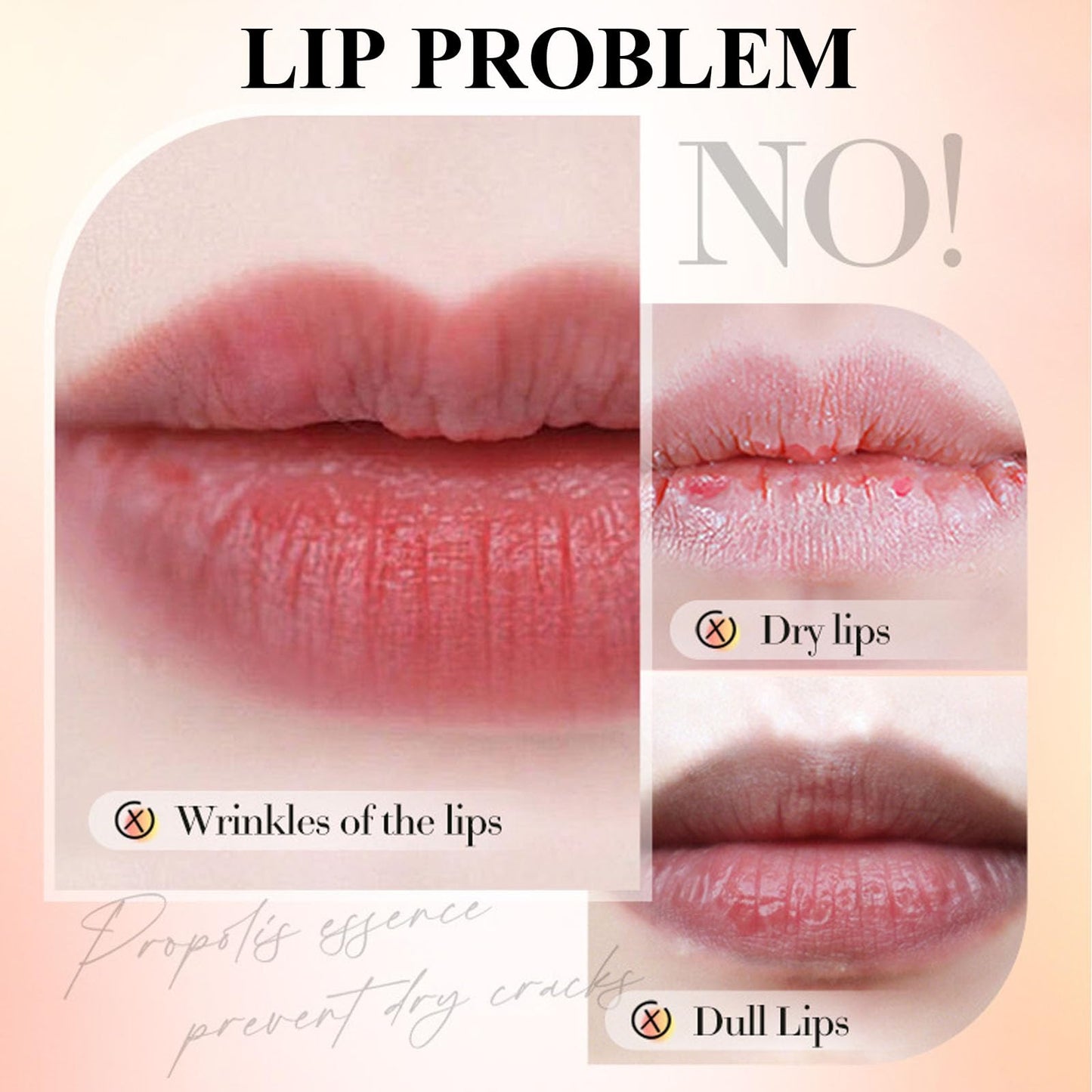 ARCHIDATE Lip Sleeping Mask for Dry Lips, Overnight Lip Mask, Deep Hydration, Restores Softness, Nourishes Dry Chapped Lips, Enriched with Natural Strawberry Extract & Vitamin E, Smooth Fine Lines