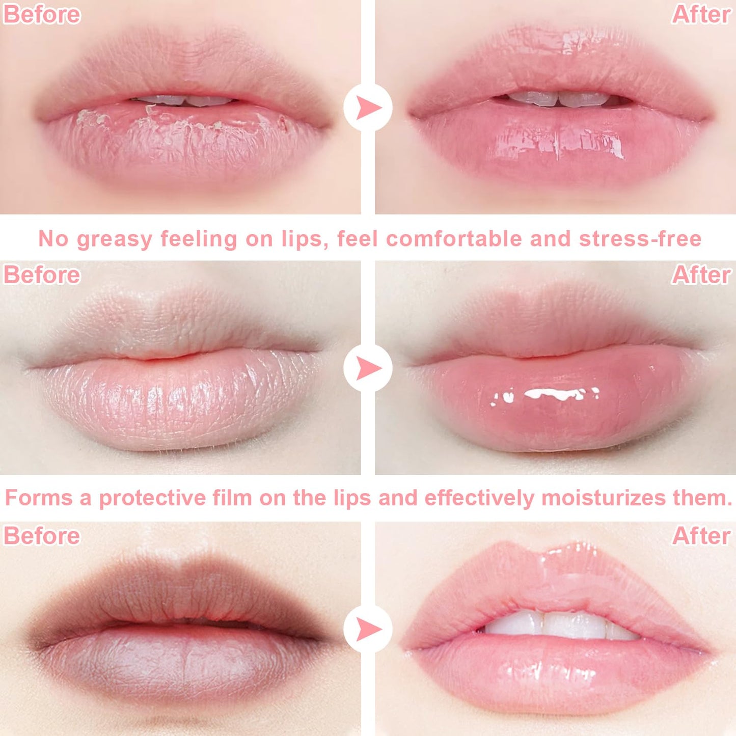 6 PCS Bee Lip Balm Honey Pot, Propolis Lip Mask Overnight, Moisturizing Hydrating Lip Sleeping Mask Prevention Dry and Cracked, Reduce Lip Lines (Strawberry&Watermelon&Honey&Cherry&Coconut&Apple Lime)