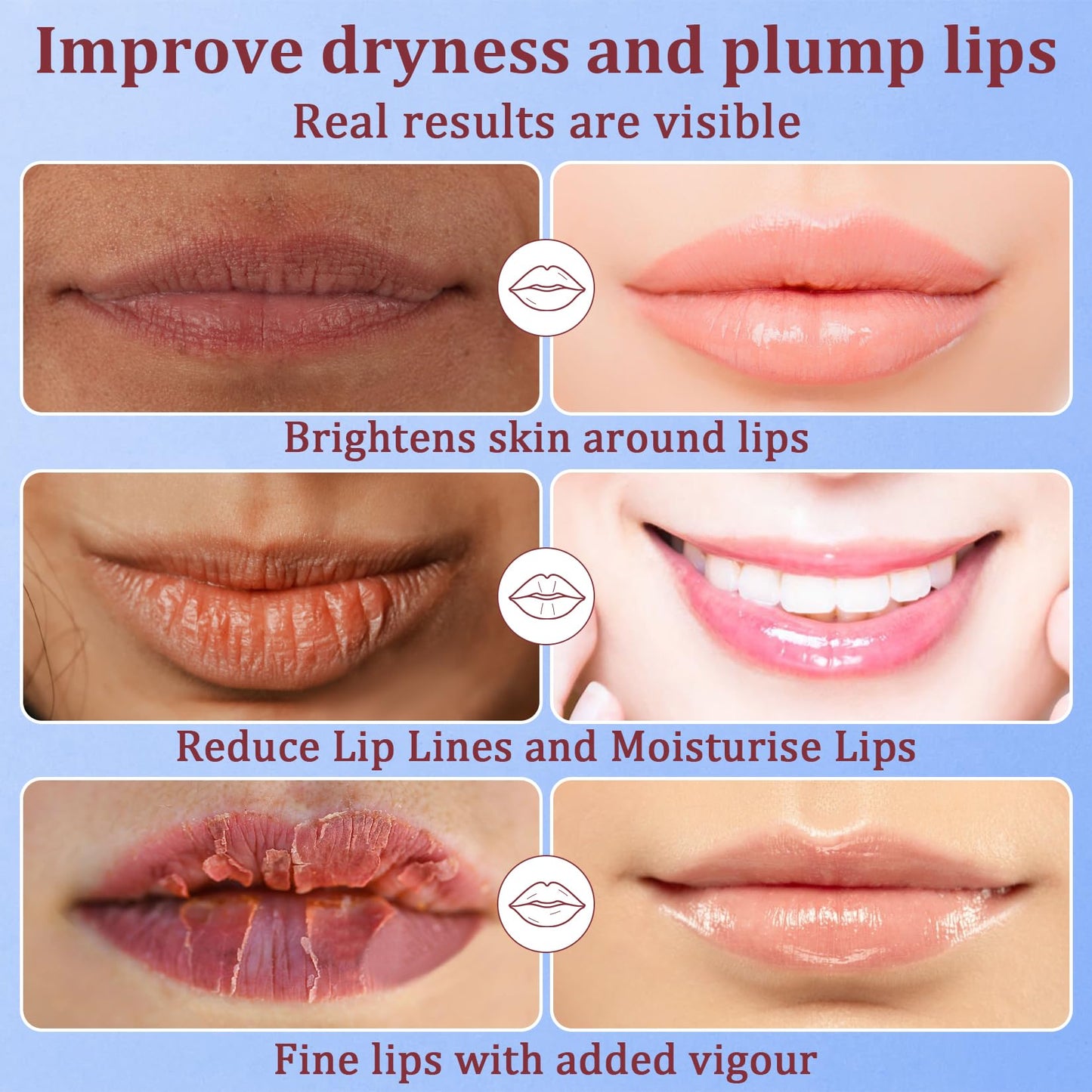 30PCS Moisturizing Lip Mask - Lip Patches for Spa Daily Labial Masks Skincare Hydrating to Reduce Wrinkles Dryness Anti-wrinkle Lightens, Blueberry