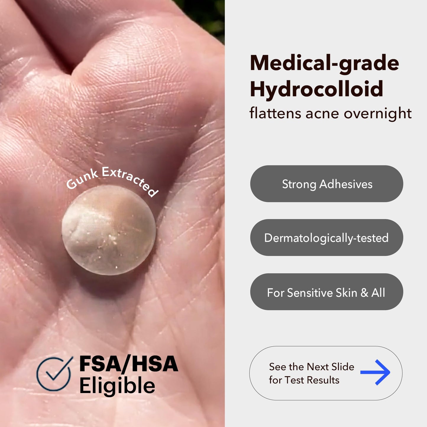 AVARELLE Hide-and-remove Kit Pimple Patches | Hydrocolloid Acne Patches for Blemishes and Zit for Face, Vegan, Cruelty Free