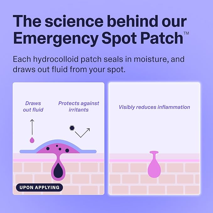 Curology Emergency Spot Pimple Patches for Face, Hydrocolloid Pimple Patches Fast-Acting, 160 Count