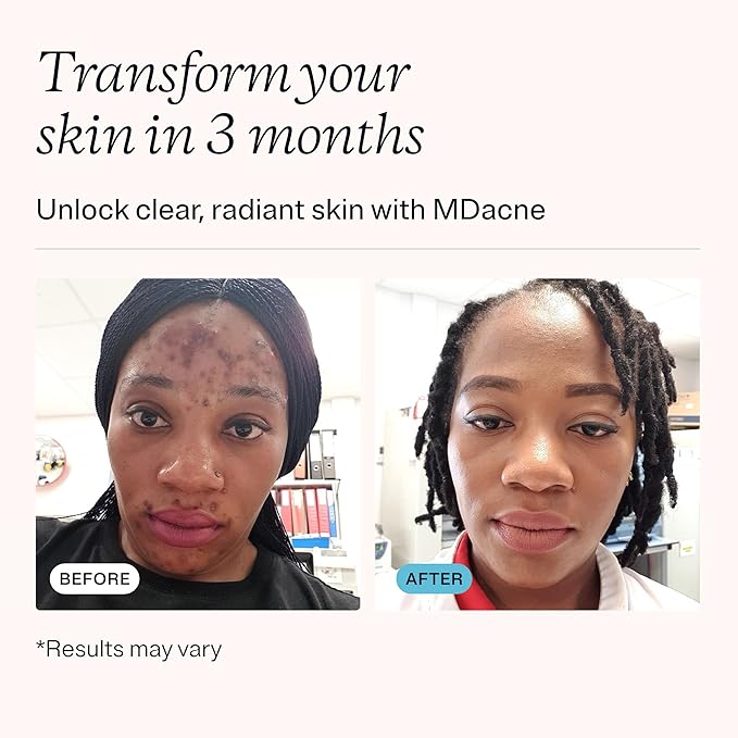 MDacne 3 Step Retinol Acne Kit - Retinol Cream 0.25%, Salicylic Acid Cleanser, Niacinamide Moisturizer - Plant-Based products for Hormonal Acne, Blemishes, and Wrinkles. 30 Day Complete Acne Care Kit