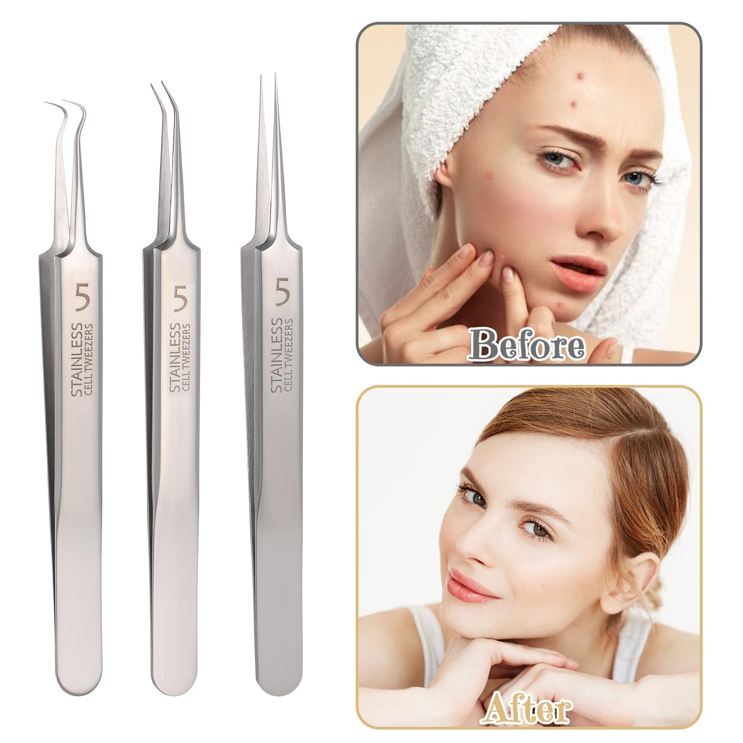 4 Pcs Clay Facial Mask Set - Turmeric, Vitamin C, Green Tea, Dead Sea Mud, and Rose Clay Skin Care Mask for Deep Cleansing, Moisturizing, and Refining Pores - 240g