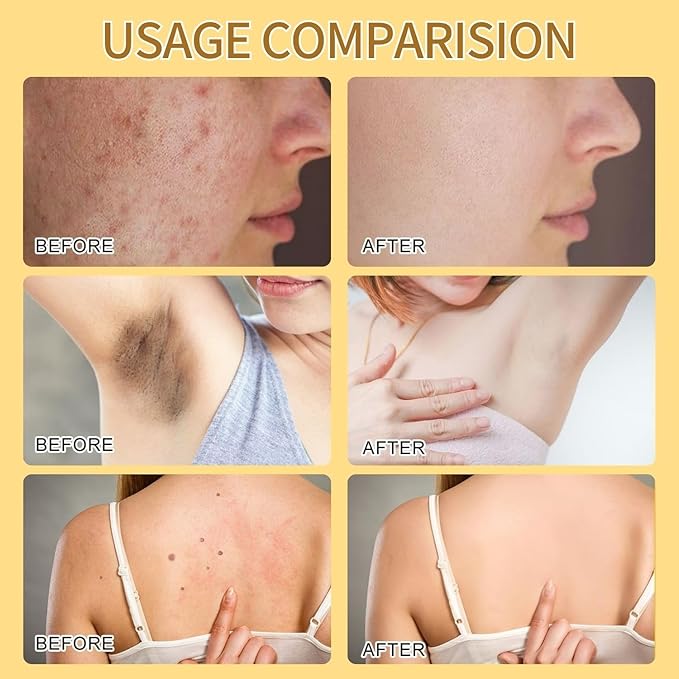 2PCS Bee Venom Skin Treatment Cream, Bee Venom Cream, New Professional Bee Ve-nom Repair cream, Bee Ve-nom Moisturizing Cre-am for All Skin Types